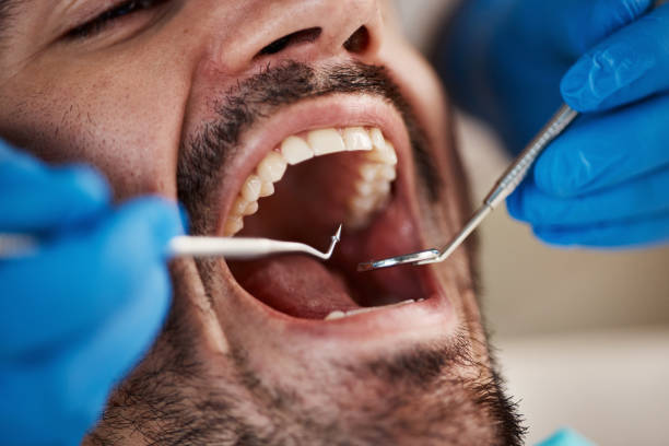 TMJ/TMD Treatment in Westerville, OH