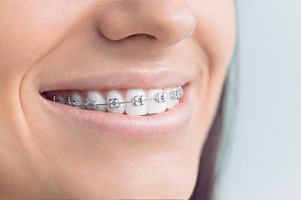 Best Oral Cancer Screening  in Westerville, OH